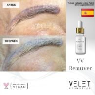 VV REMUVER – Image 4