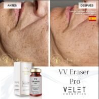 VV ERASER PRO – Image 4