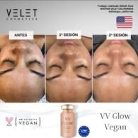 VV GLOW - BRONZE – Image 5