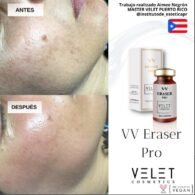 VV ERASER PRO – Image 5